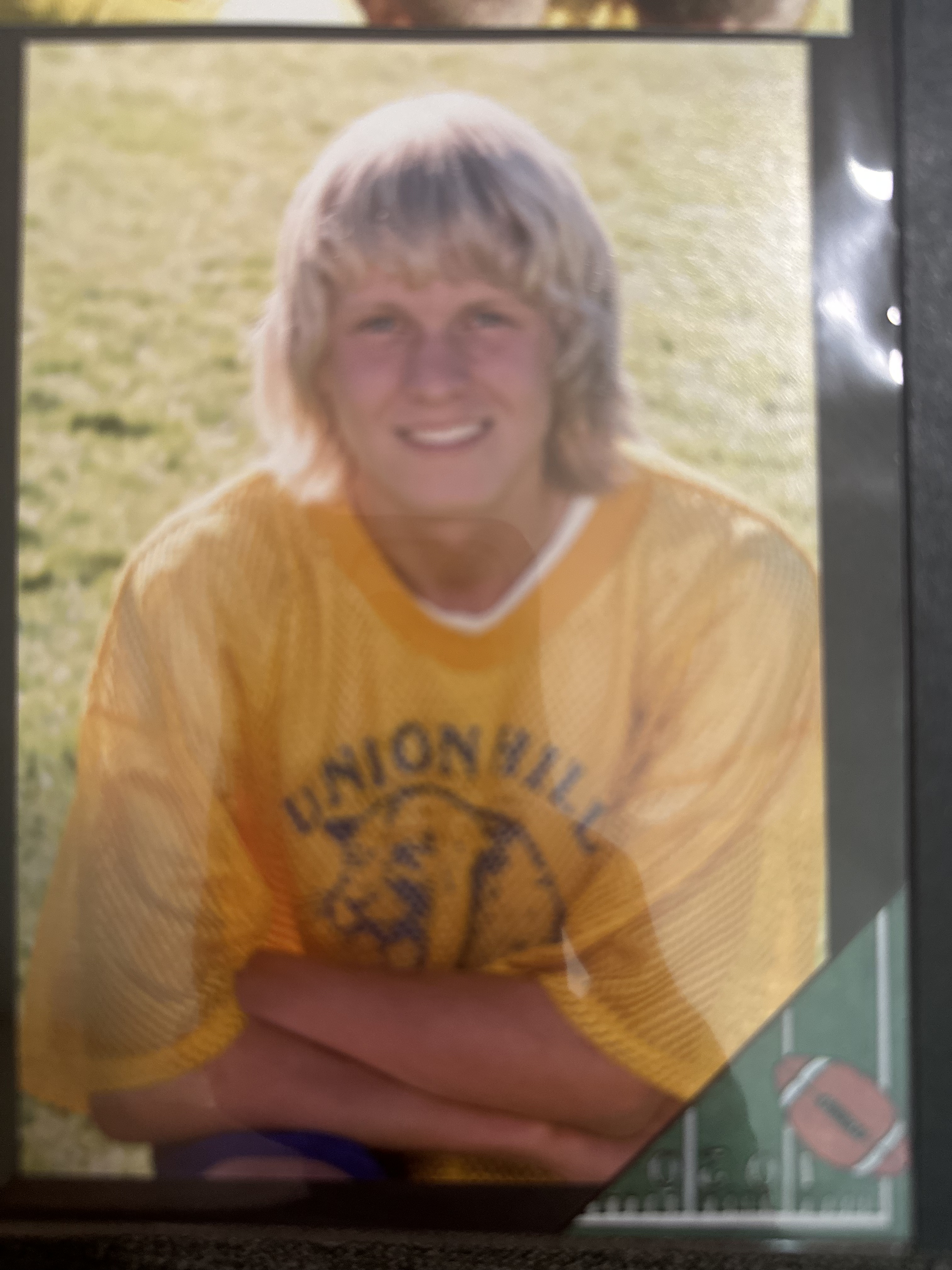 bro what is that hair?